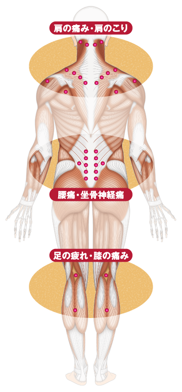 スポールバン | 祐徳薬品工業株式会社